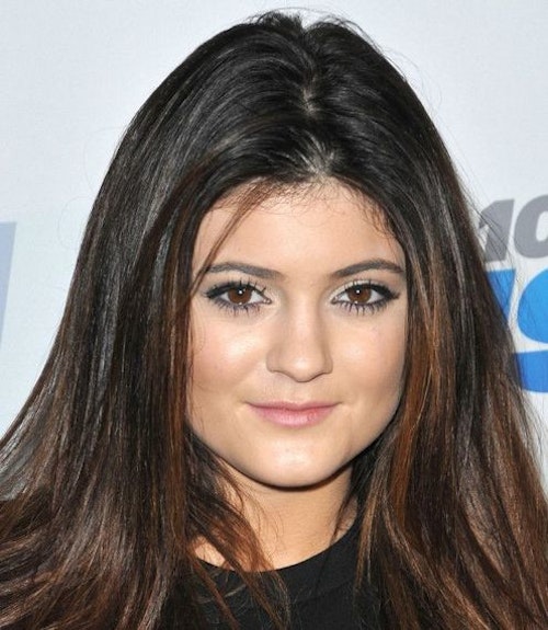 Kylie Jenner Before And After Plastic Surgery Celebrity Heat 